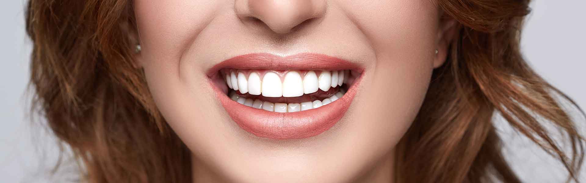 close up of young lady smiling with beautiful white teeth